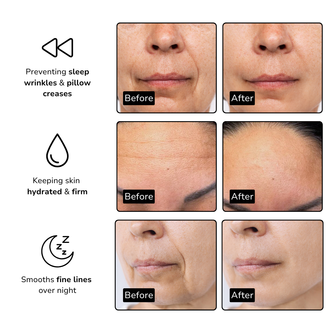 Anti Wrinkle Patches
